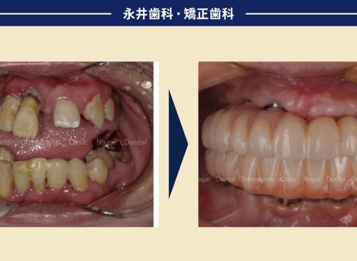 10年前の治療から再び