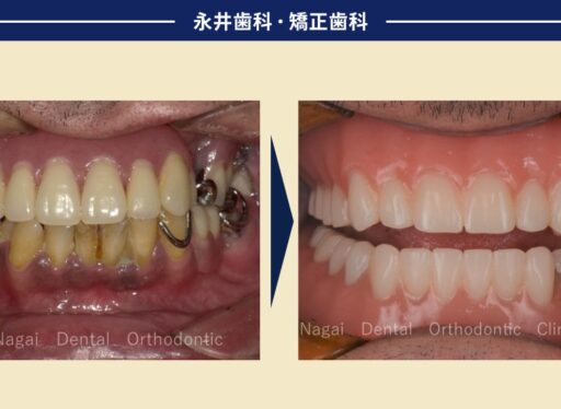 40代男性。本当にちゃんとした歯が手に入る？